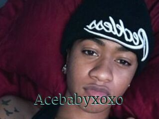 Acebabyxoxo